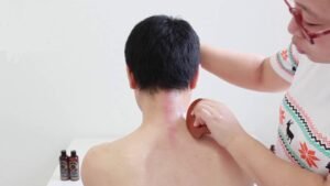 gua sha benefits
