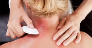 gua sha use for health problem