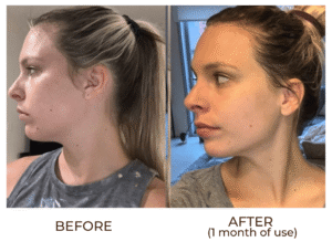 after gua sha